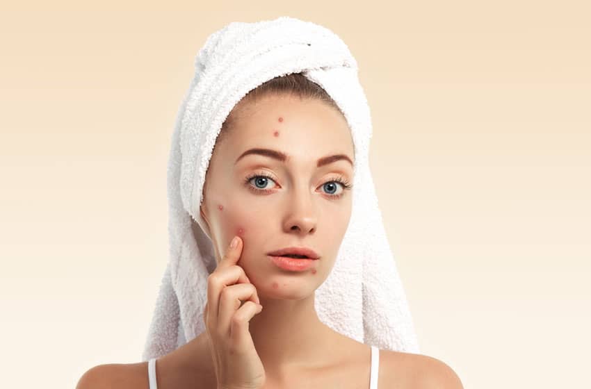 Natural Home Remedies For Oily Skin