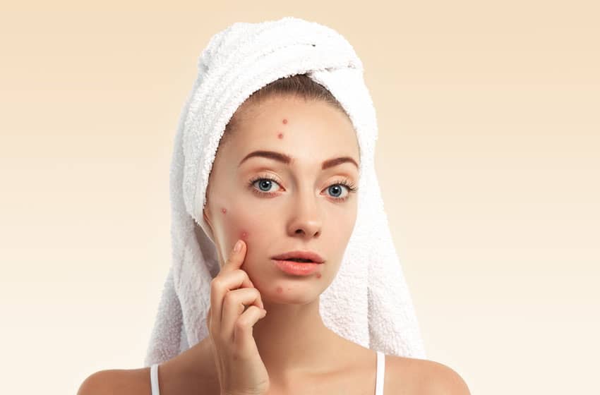 Natural Home Remedies For Oily Skin KPH Media India natural-home-remedies-for-oily-skin-kph-media-india